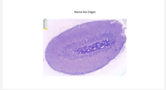 <p>name the organ</p>