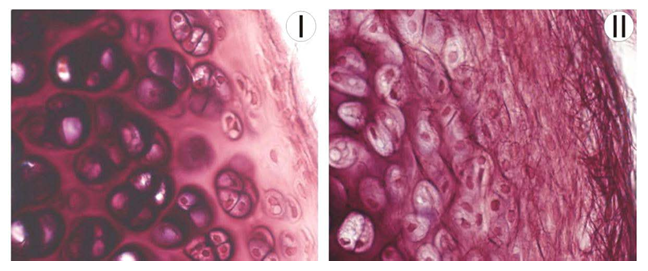 <p></p><p><strong>A17) Specify the combination of extracellular matrix fibres that are the typical components of tissues I and II</strong></p><p>A. Tissue I: elastic fibers; tissue II: type IV collagen. </p><p>B. Tissue I: reticular fibers; tissue II: type IV collagen. </p><p>C. Tissue I: Type I collagen and elastic fibers; Tissue II: Reticular fibers.  </p><p>D. Tissue I: Type II collagen; tissue II: type II collagen and elastic fibers.  </p><p>E. Tissue I: Type II collagen; Tissue II: Reticular fibers. </p>