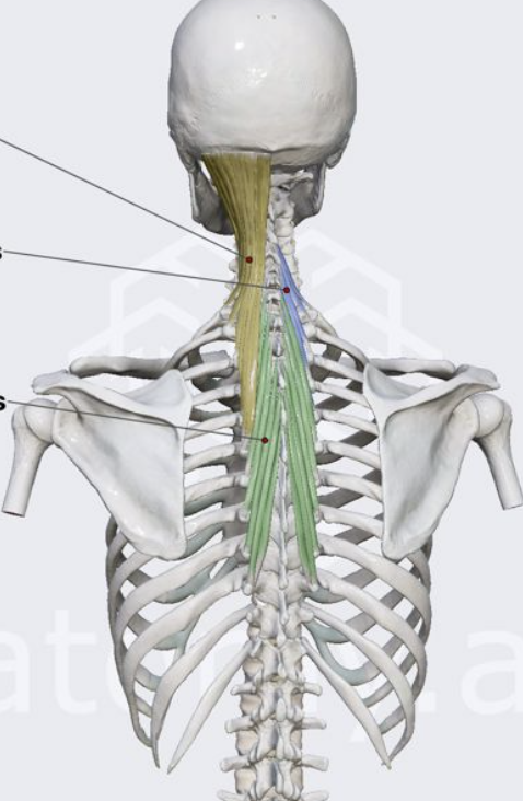 <p>Which muscle is in yellow?</p>
