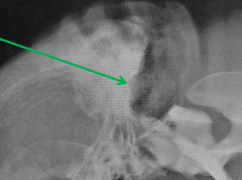 term image