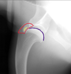 <p>What is the purple line</p>