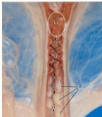 <p>Which species cervix is this?</p>