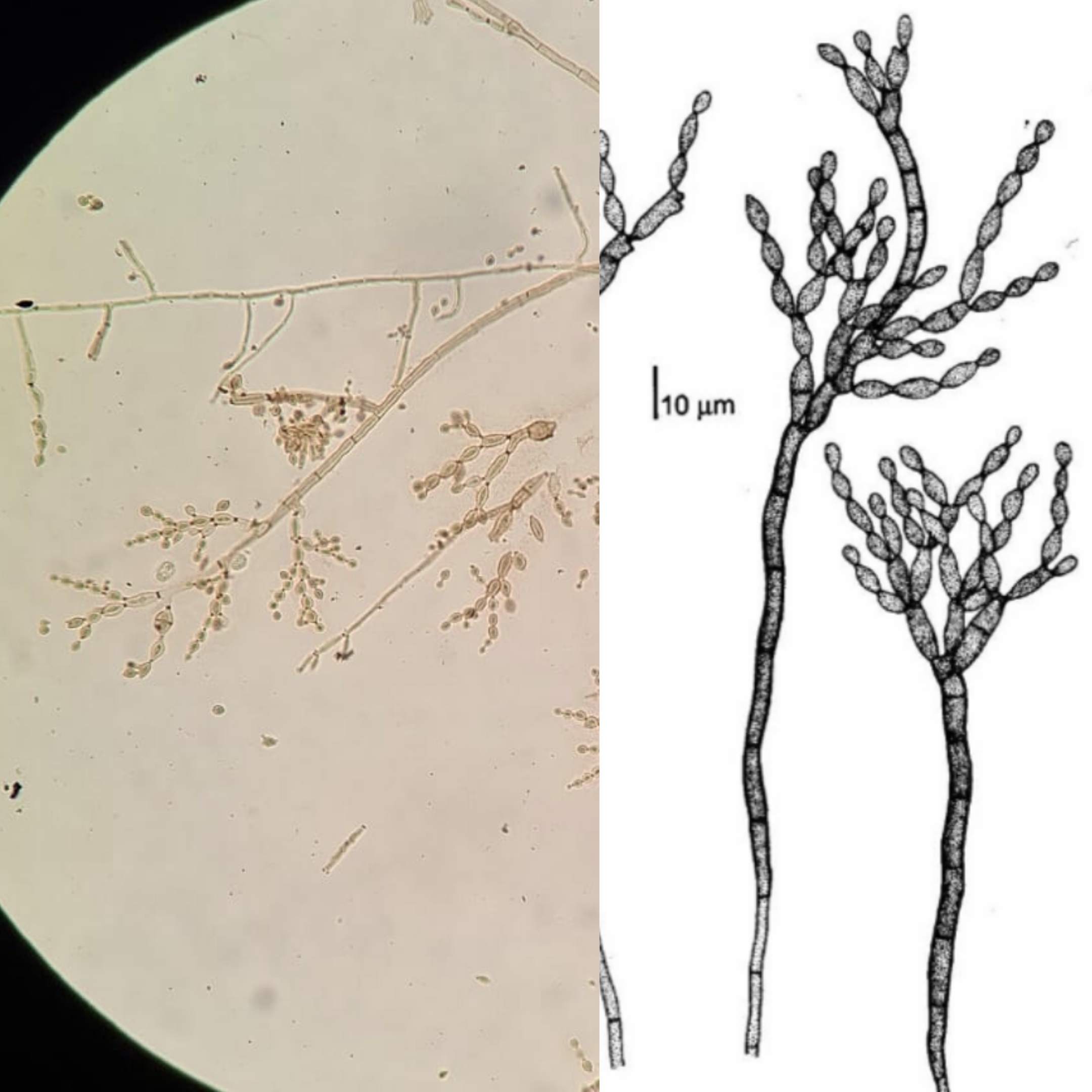 <p>Indica:</p><p class="has-focus">Se é fungo filamentoso inferior ou superior</p><p class="has-focus">O gênero do fungo</p><p class="has-focus">Características que o distingue</p>
