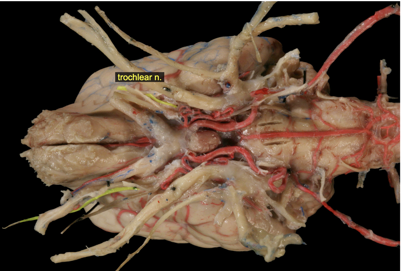 <p>trochlear, hard to identify grossly </p>
