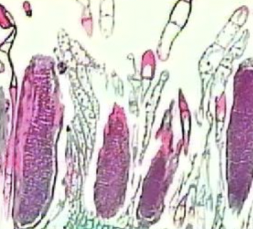 <p>male reproductive organs</p><ul><li><p>multicellular structures found in clusters within the "splash cup" or apical rosettes of male gametophytes. looks like a club</p></li><li><p>Produce and release biflagellate sperm</p></li></ul><p></p>