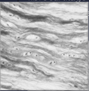 <p><span>fibrocartilage</span><br><span>- chondrocytes scattered among bundles of collagen fibers</span></p>