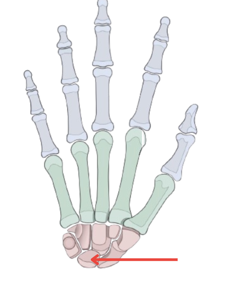 term image
