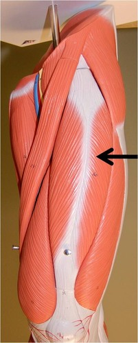 <p>What muscle is this?</p>