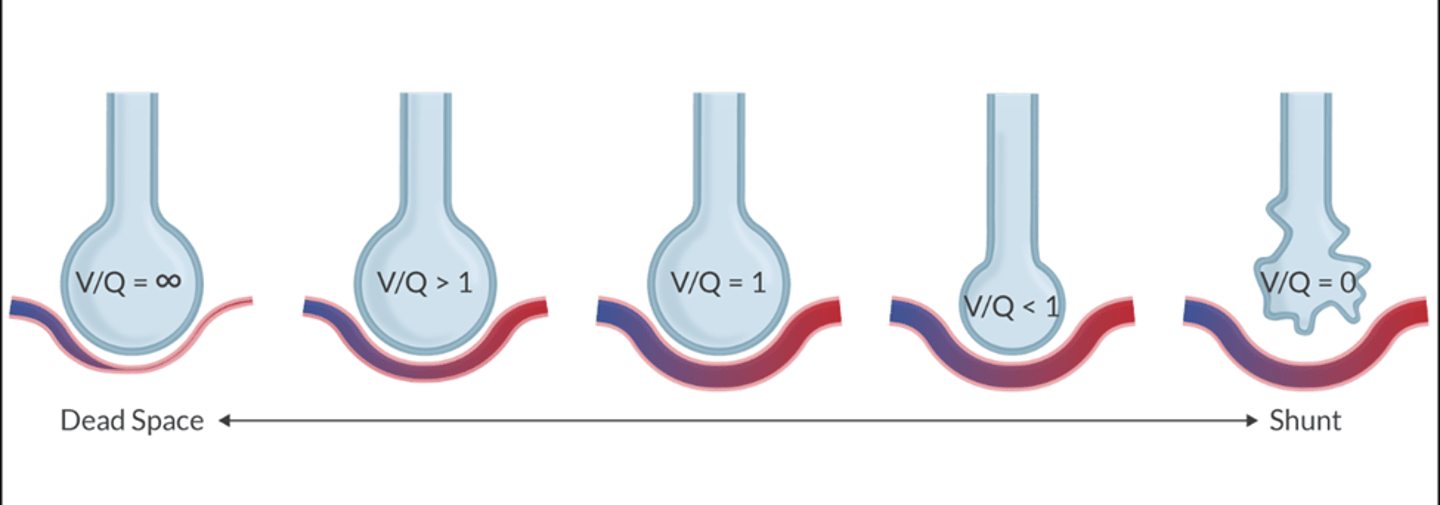 <p>normal V/Q= 0.8</p><p>V/Q=1 is perfect match</p>
