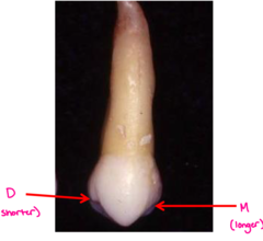 <p>On maxillary premolars, is the distal or mesial marginal ridge located more cervically?</p>