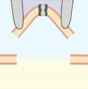 <p>pipette takes a small vesicle of membrane with it away from cell and exposes intracellular surface to air </p><ul><li><p>allows it to change the medium that the intracellular surface is exposed to</p></li></ul><p></p>