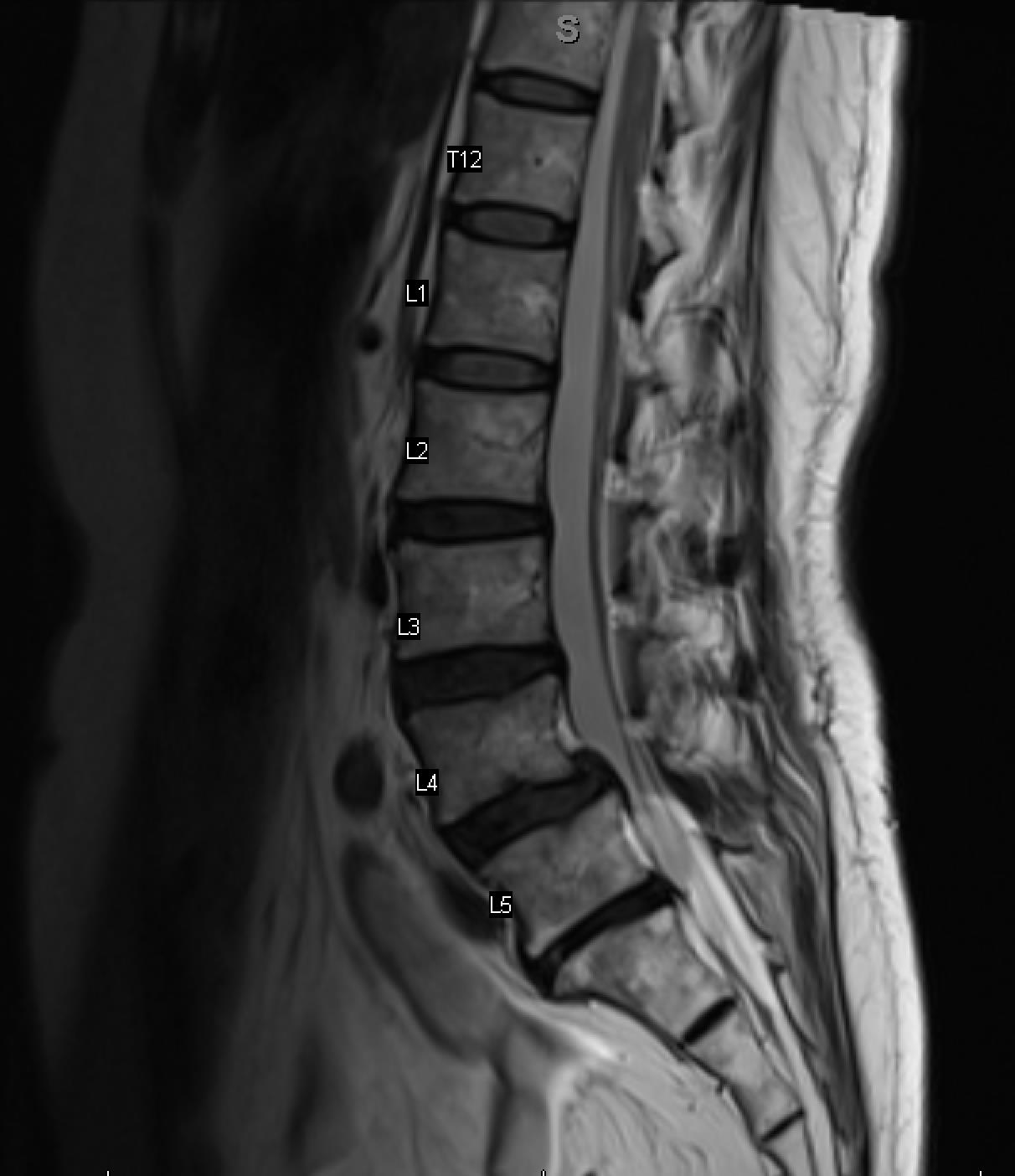 <p>What is the diagnosis?</p>