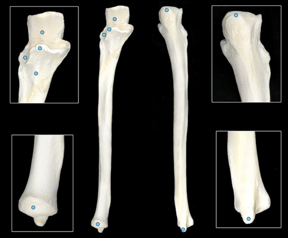 <p>medial forearm</p>
