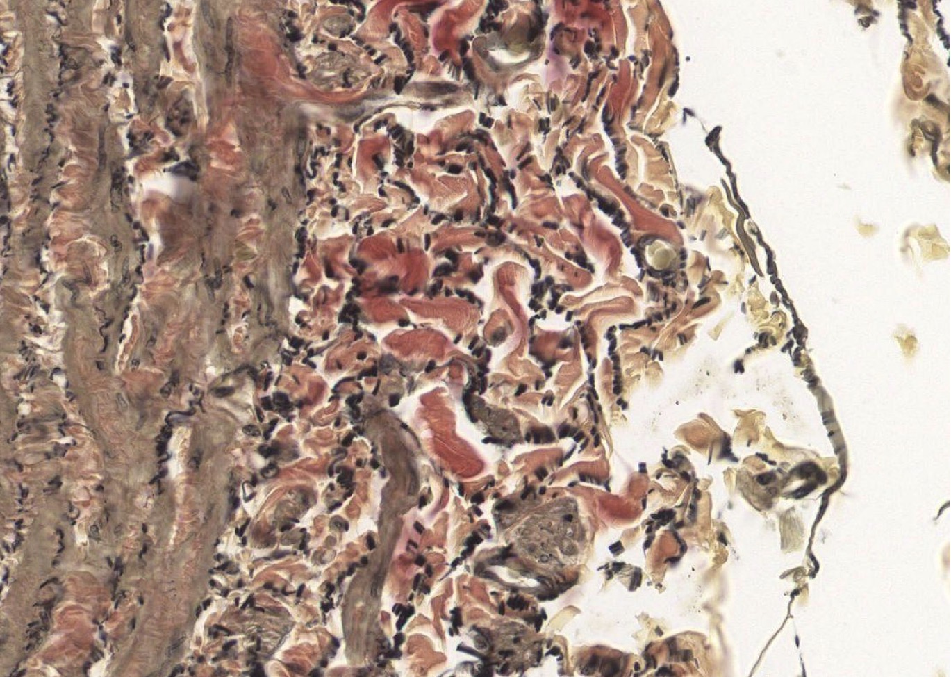 <p>Identify the Vessel and the Layer pictured</p>