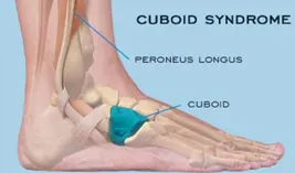 <p>What bone is this?</p>