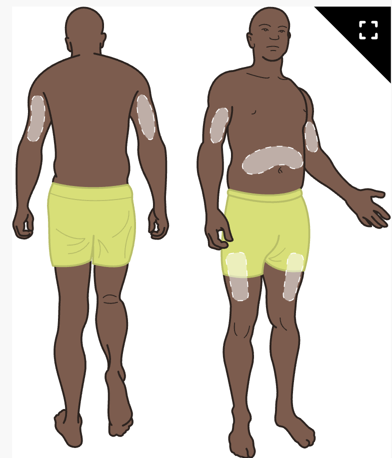 <p><sup>5</sup><span>/</span><sub>8</sub><span> inch needle</span></p>