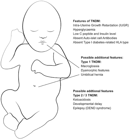 <p>transient neonatal diabetes mellitus (TNDM)</p>