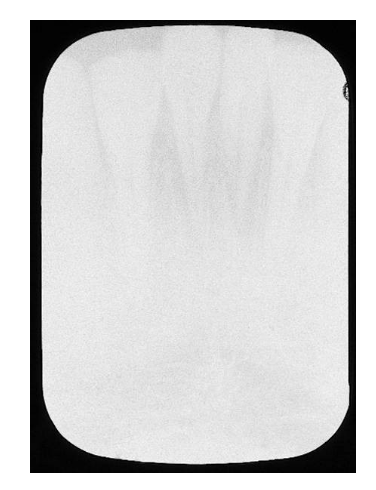 <p>Underexposed Film </p>