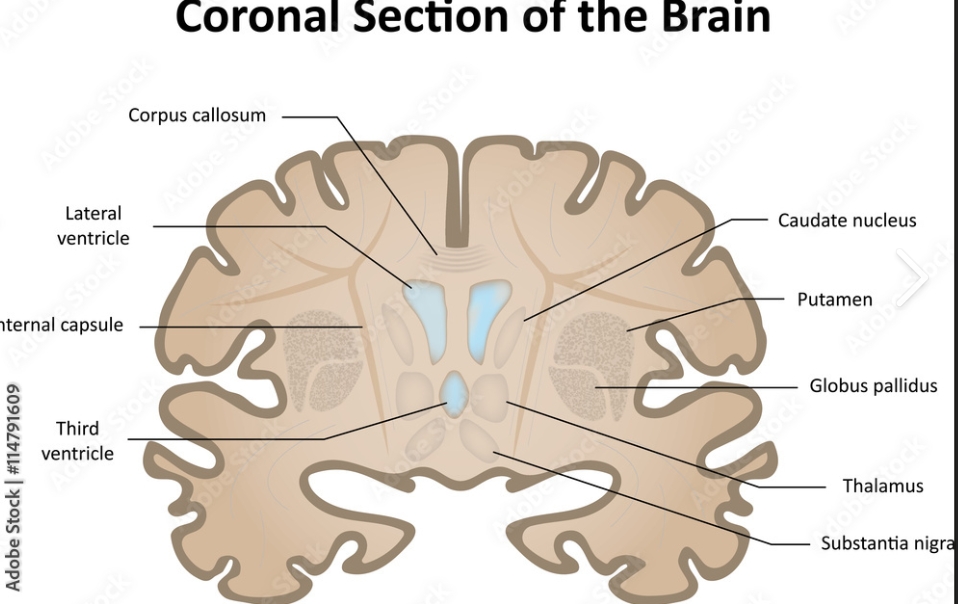 <p>Coronal</p>