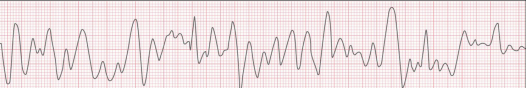 <p>What should be pushed in this patient?</p>