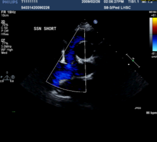 <p>Describe the findings of this image.</p>