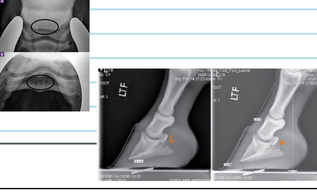 <p>Navicular Disease/ Palmer Digital Pain: D.X</p>