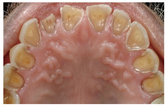 <p>CHẨN ĐOÁN?</p>