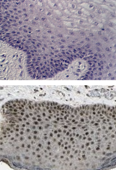 <p>Basal Cells (epithelial) </p>