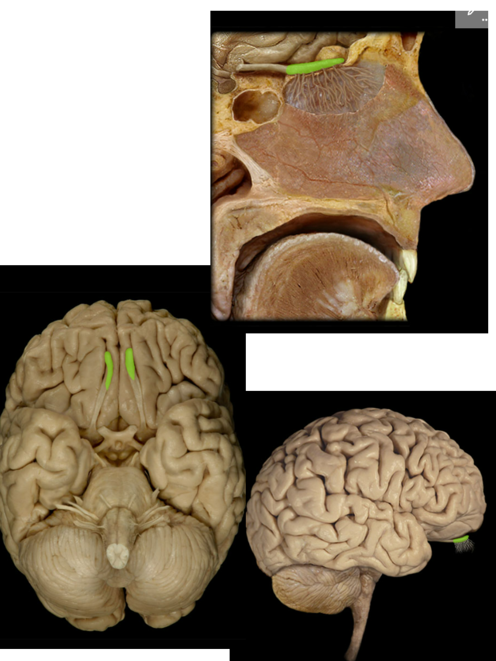 <p><span>Olfactory bulb</span></p>