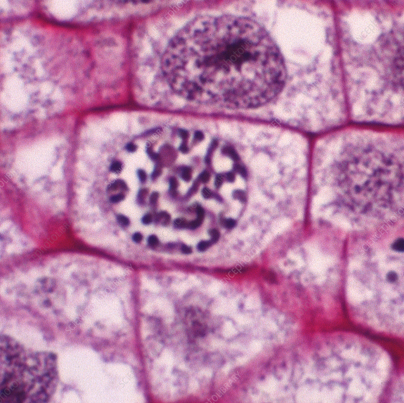 <p>nucleus is still present; chromosomes are condensing</p>