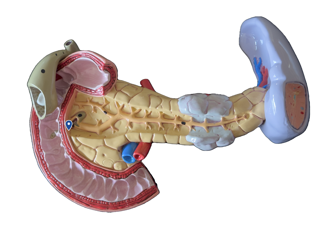 <p>Name this opening.</p>