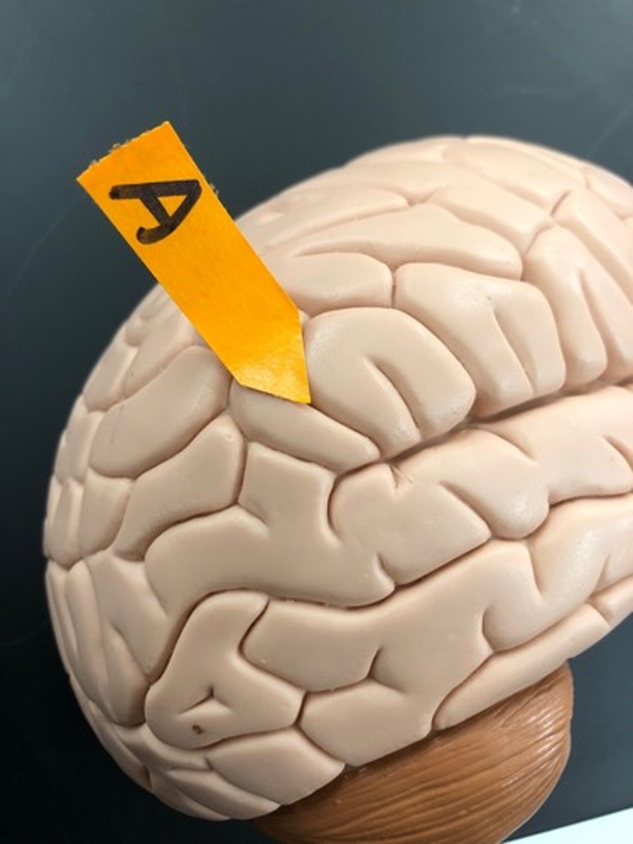 <p>Identify the structure (general name for the shallow indentation on the surface of the brain).</p>