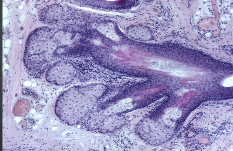 <p>Explain anatomy of exocrine gland </p>