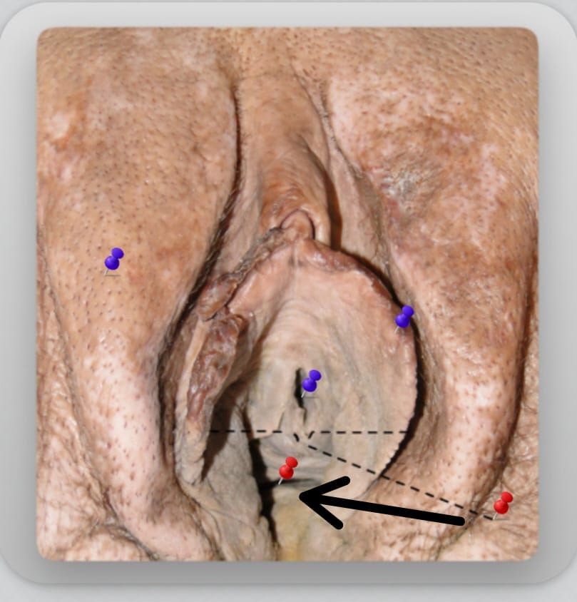 term image