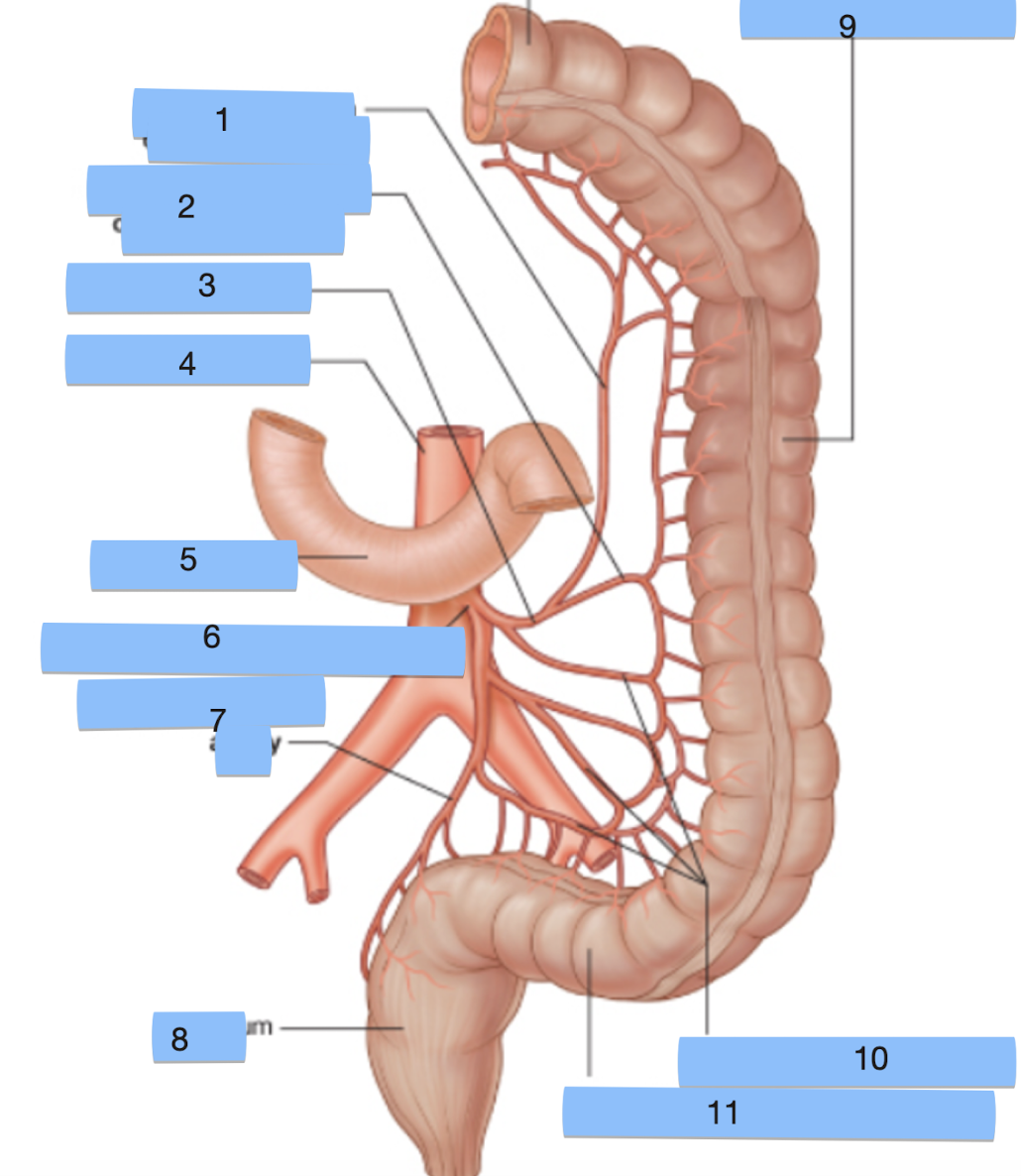 <p>What structural label has been cut out of the top of this image?</p>