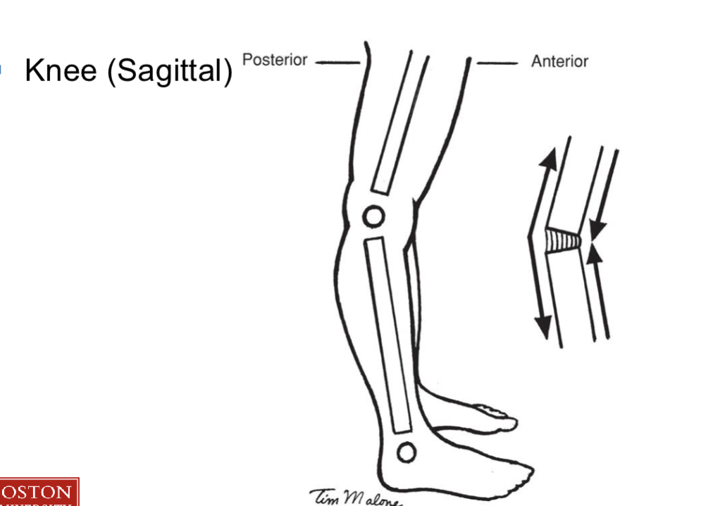 <p>LoG is anterior → wanting extension </p><p></p><p>Tension forces give internal moment of flexion to stop excessive extension</p>