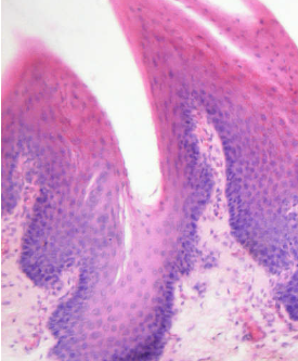 <p>soort epitheel</p>