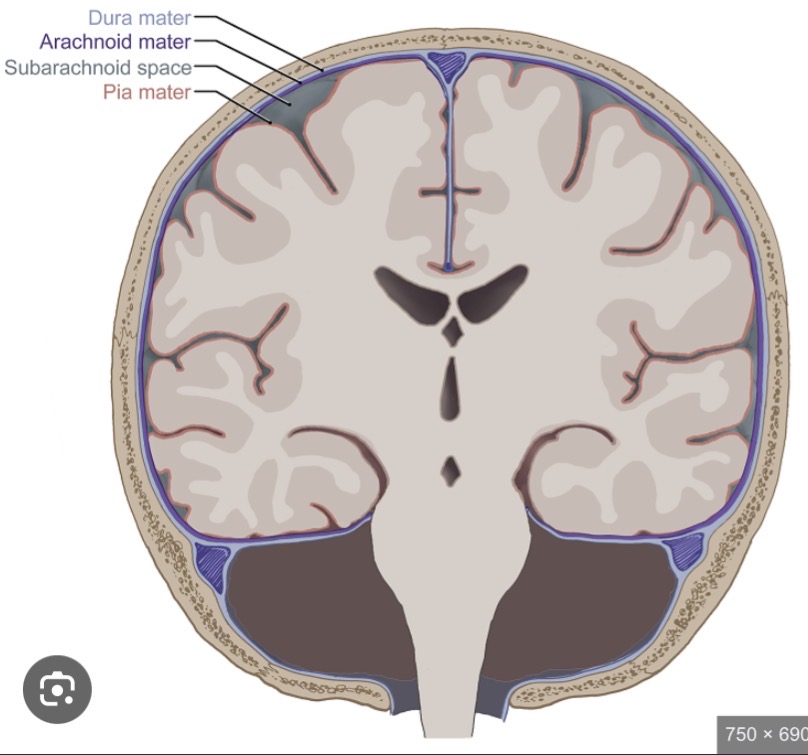 <p>Subarachnoid space</p>