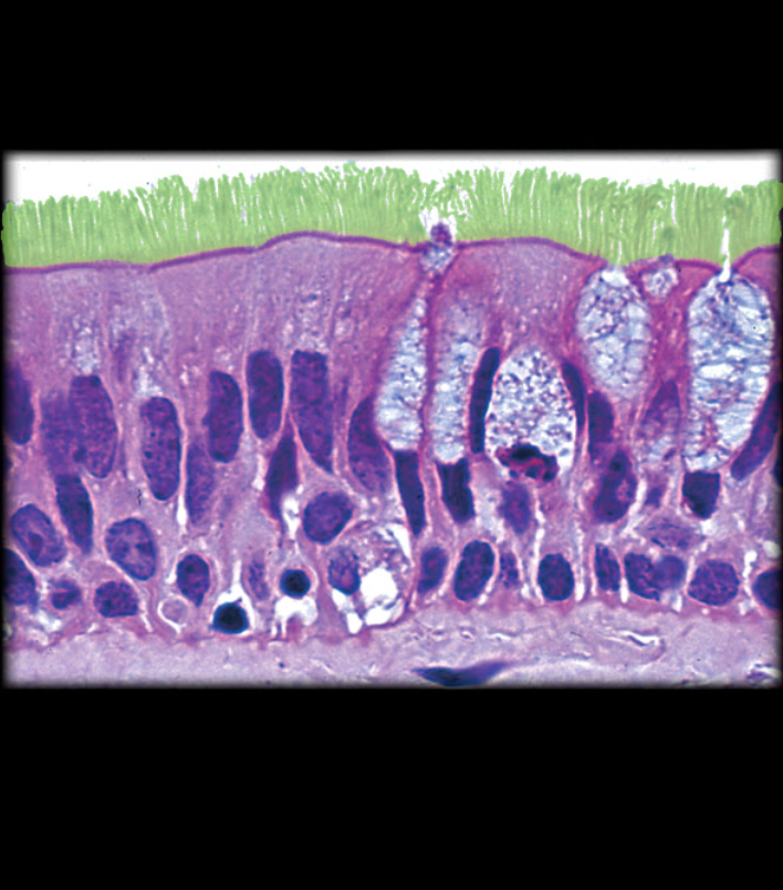 term image