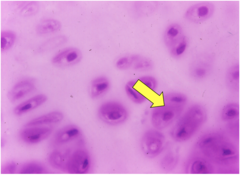 <p>Identify the specific region at the tip of the yellow arrow in hyaline cartilage</p>