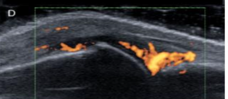 <p>Grade this doppler</p>