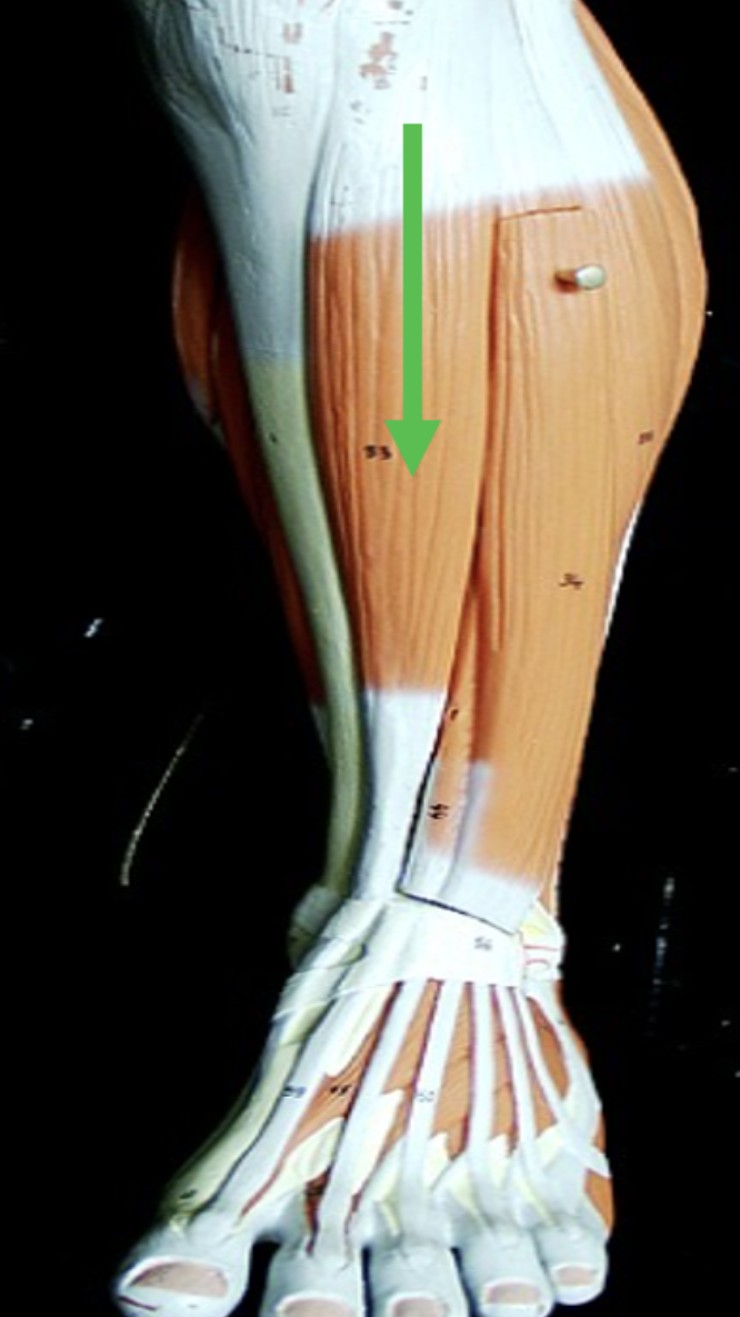 <p>Identify the muscle indicated by the pointer.</p>