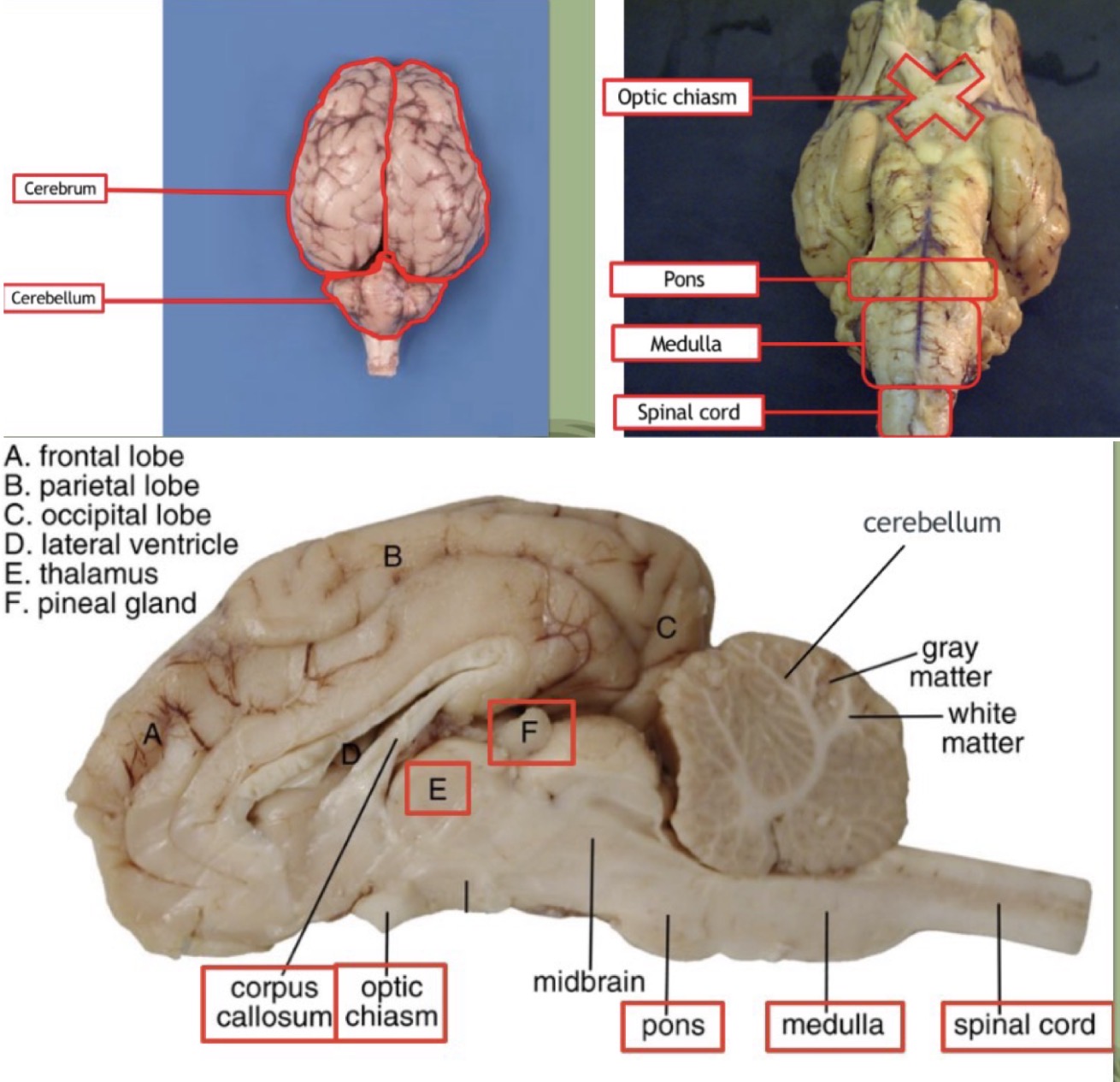 <p>cerebrum —> sensory and motor</p><p>cerebellum —> balance</p><p>medulla oblongata —> control of automatic functions (breathing, swallowing, heartrate)</p><p>corpus callosum —> connects the two halves of the brain, inter-hemispheric communication</p><p>optic chiasma —> where the optic nerves cross one another</p><p>pituitary gland —> part of endocrine system, hormone secretion</p><p>hypothalamus —> controls pituitary, homeostasis</p><p>pons —> unites messages from cerebellum and cerebral cortex (brain halves)</p><p>pineal body —> involved in biorhythms (puberty)</p><p>thalamus —> sensory integration and relay to cerebrum</p><p>meninges —> protective covering</p>