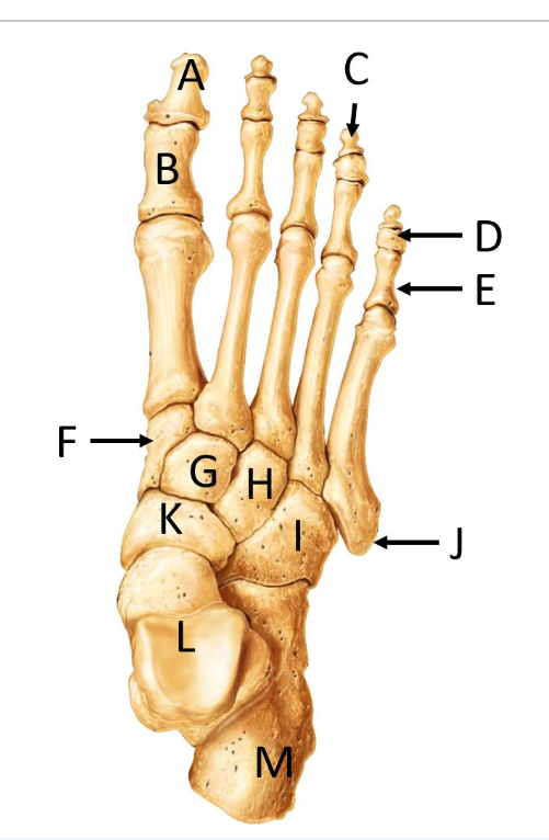 <p>What structure is identified by the letter I?</p>