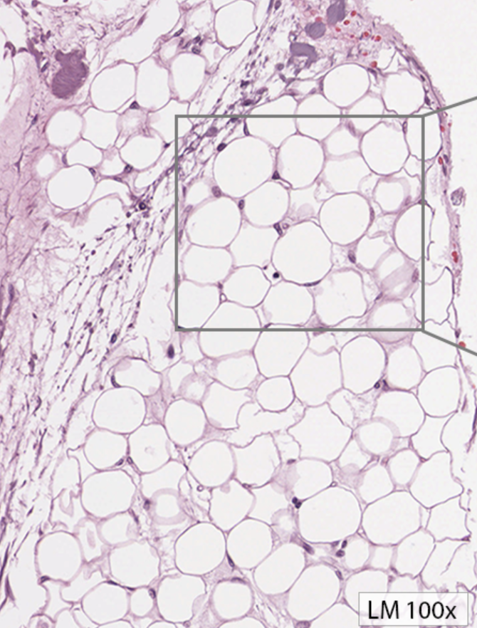 <p>What kind of connective tissue is this?</p>