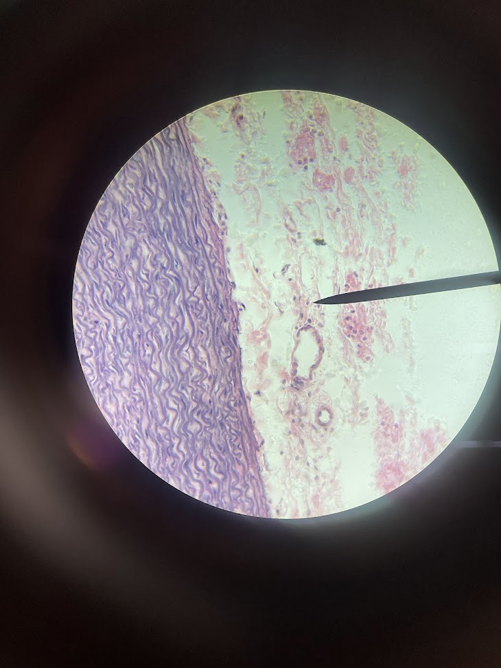 <p>structure name + layer name</p>