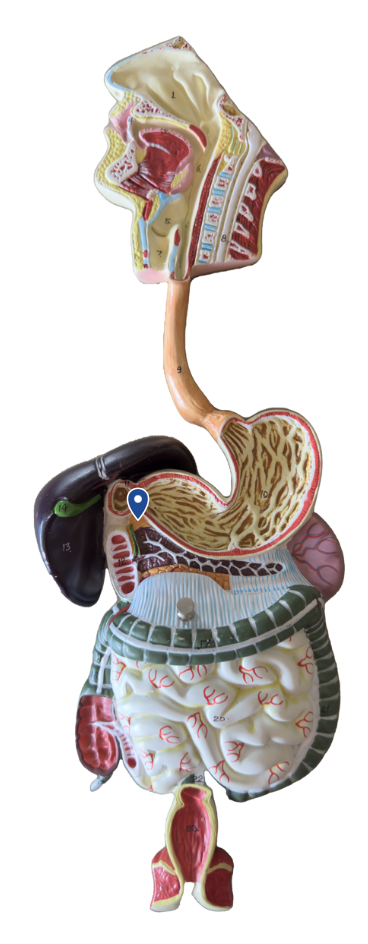 <p>Name this opening.</p>