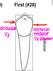 <p>What is the only tooth in the mouth that has a mesial contact more cervical than the distal?</p>