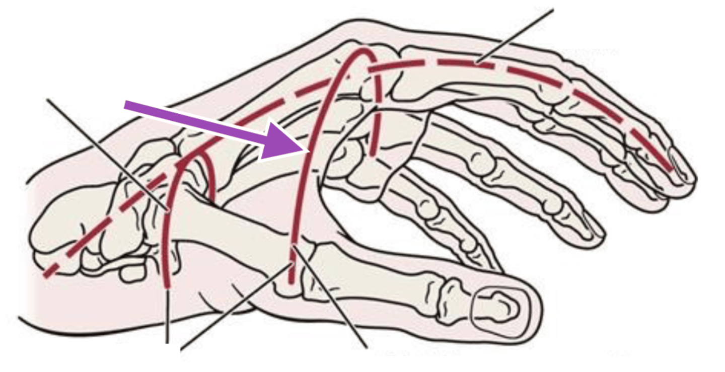 <p>Found at the level of the MCP joints</p>