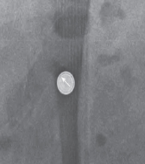 <p>Black line within the outer edge.</p>